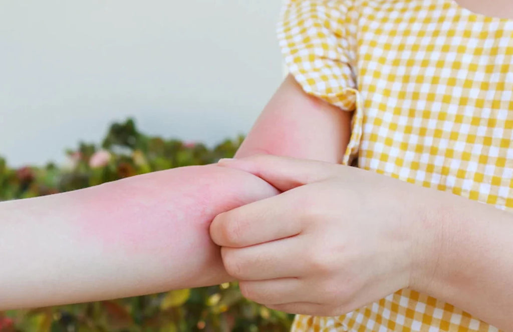 What Causes Skin Itchiness and How to Avoid them in Children