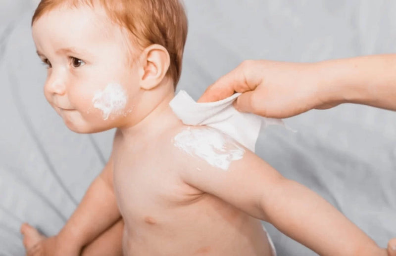 9 Natural tips to make the baby's skin fair