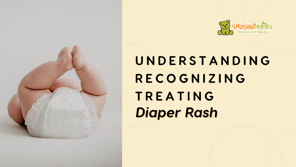 Understanding, Recognizing, and Treating Diaper Rash