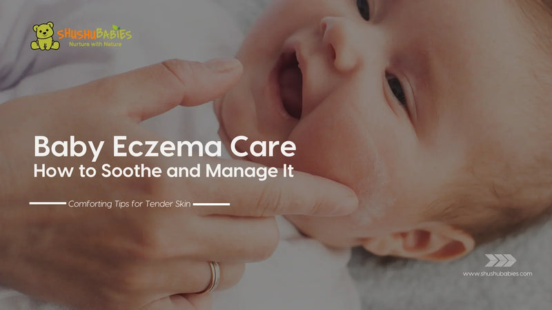 Baby Eczema Care: How to Soothe and Manage It