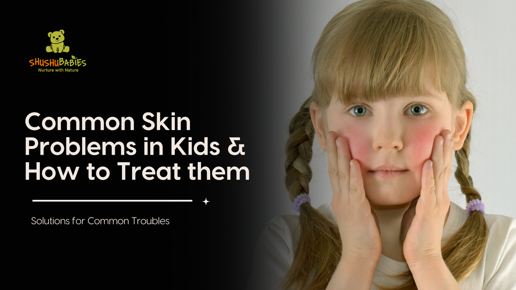 Common Skin problems in kids & How to treat them 
