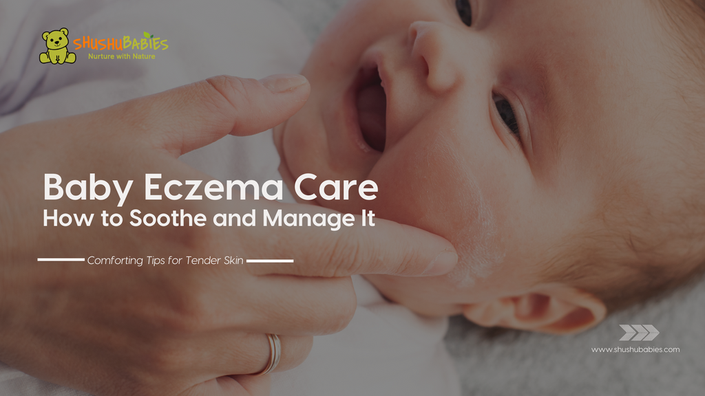 Baby Eczema care 