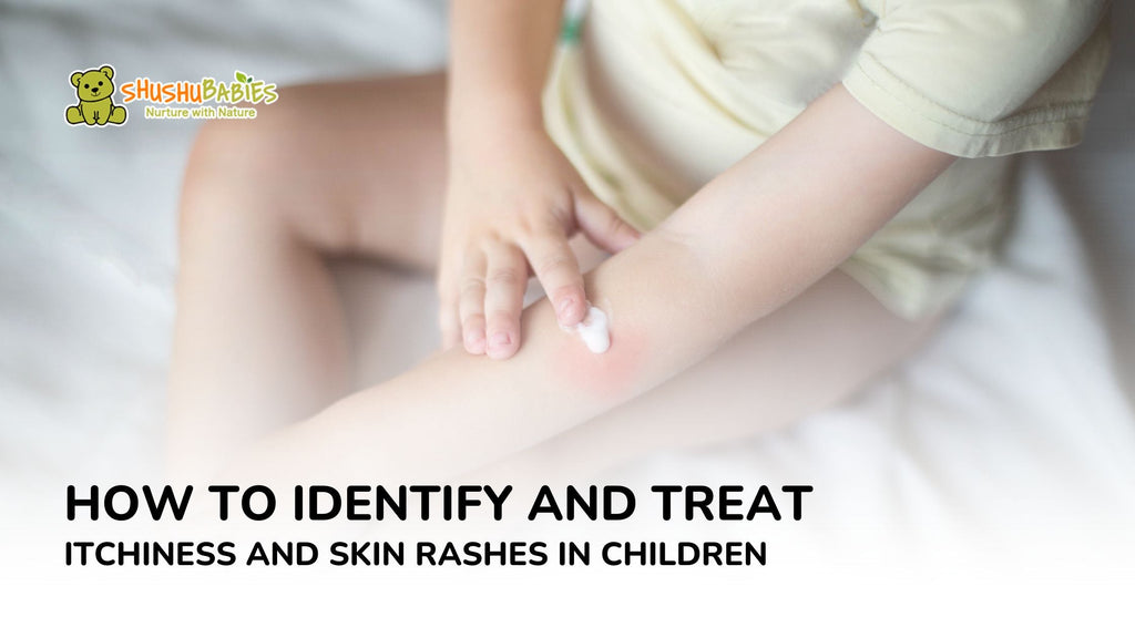 How to Identify and Treat Itchiness and Skin Rashes in Children