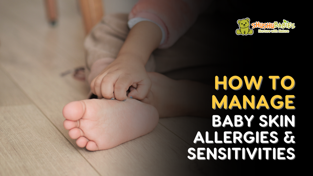 How to manage baby skin allergies & sensitivies 