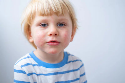 Treats Allergies